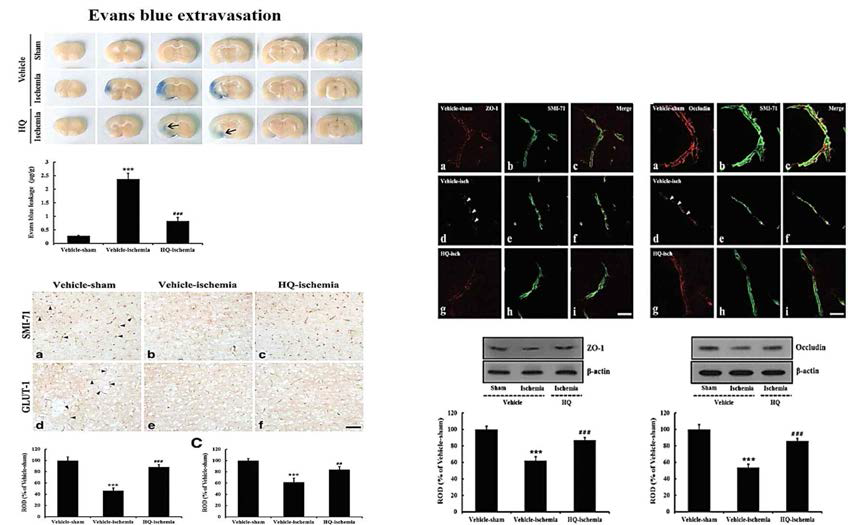 일시적 국소허혈 동물모델에서 HQ의 혈액뇌장벽 integrity 회복 작용