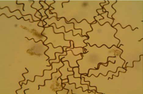 본 연구에서 선정된 종(Arthrospira platensis)의 현미경 관찰 사진