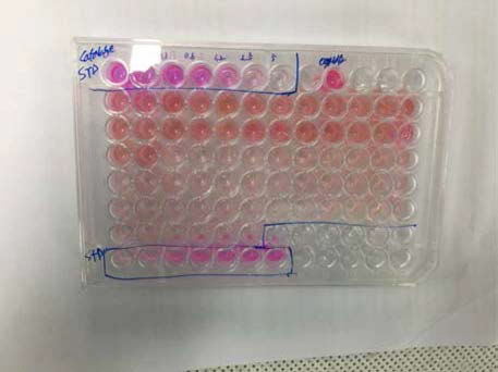마우스에서 적출한 간의 Catalase 효소를 분석하기 위해 형광분석 전 샘플을 시약으로 염색한 모습