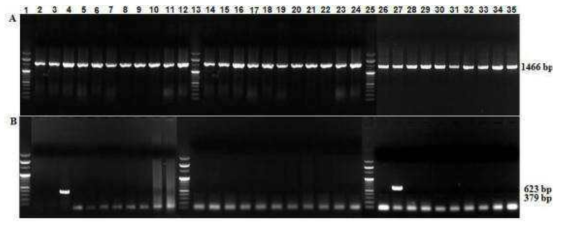 PCR 방법을 통해 수행한 비브리오 안구일라움(V. anguillarum) 및 에드와드시엘라 타르다(E.tarda) 세균을 특이적으로 검출
