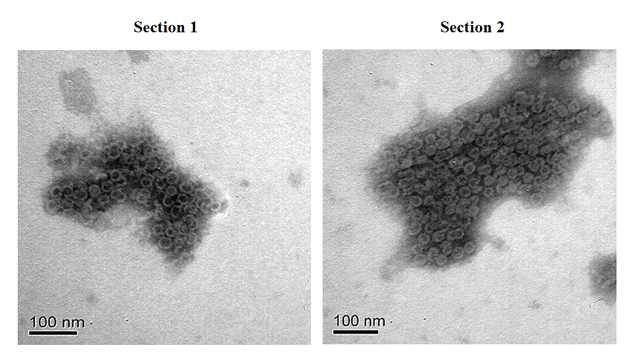 최종 정제된 노바이러스 바이러스 유사입자의 전자현미경 분석, Bars, 100 nm