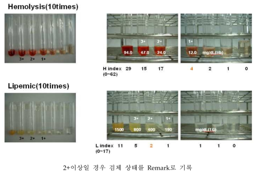 혈청 인덱스 기준표