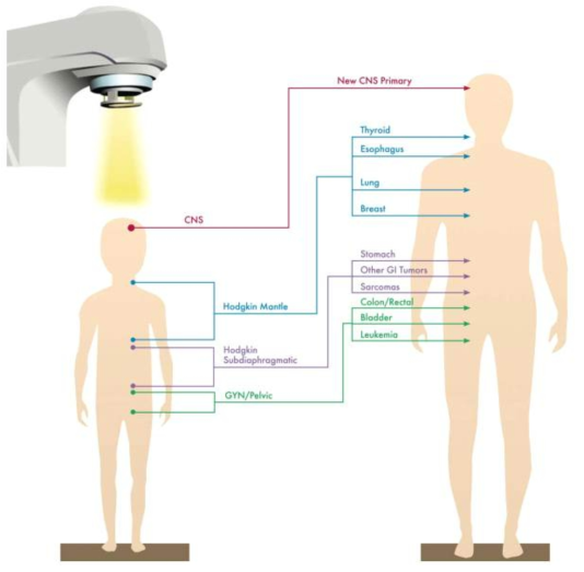방사선 조사로 이한 이차암 발생 위험의 부위별 분포 (adpated from Kamran et al. 2016)