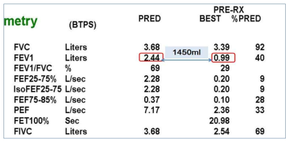 COPD 환자에서의 폐기능 검사 결과의 예. 정상 폐기능에 비해 1450ml 정도의 감소가 있음. 현재의 내과적 치료법을 다 동원해도, 300ml이상의 향상을 기대하기는 어려움
