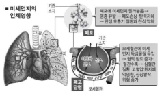 미세먼지의 인체영향(세계일보, 2005)