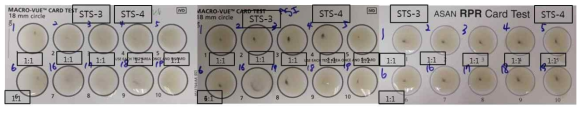 STS-3, 4의 RPR 카드 검사 결과(RPR card test results of STS-3 and 4)