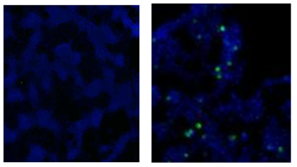 mammalian cell 에서의 후각수용체 발현 조건 탐색; (좌) GST-OR1A1 transfection, (우) RTP1, GST-OR1A1 co-transfection