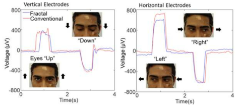 얼굴에 부착된 센서를 통해 측정된 EOG, 눈의 상하 움직임(좌), 좌우 움직임(우)