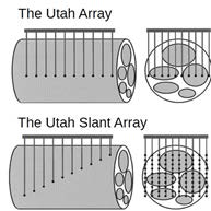 BlackRock Microsystem의 Utah Slant 어레이