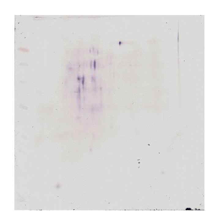 알레르기행진 그룹의 2D-Western blot 분석 이미지