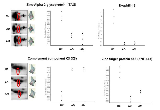 정상 (HC), 아토피피부염 단독 (AD) 및 알레르기행진 (AM) 그룹에서 ZAG, C3, exophilin 5, ZNF443 spot들의 발현량 비교