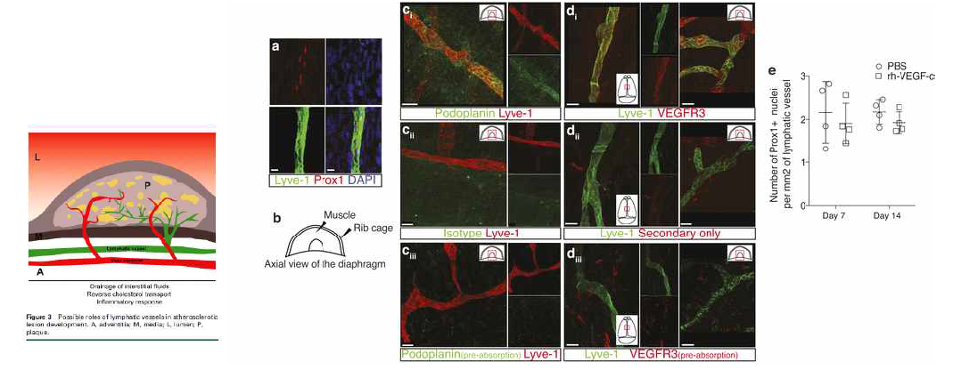 왼쪽은 lymphatic system이 atherosclerotic plaque에 관여하는 모식도이며 오른쪽은 LYVE-1 positive를 보이고 prox1 positive를 보이는 임파관이 meninges에서 관찰됨을 보여줌