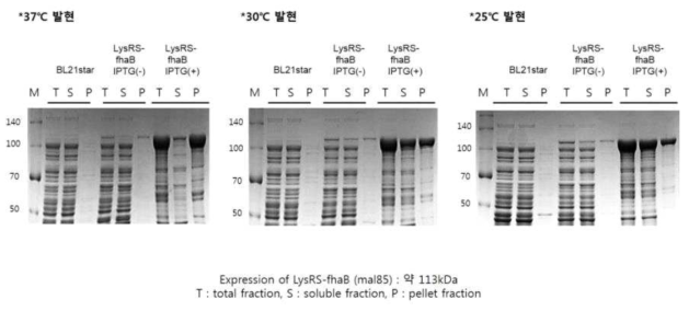백일해 LysRS-fhaB (Mal 85) 단백질 발현
