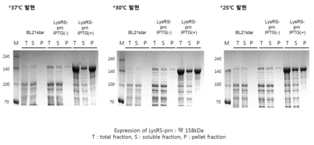 백일해 LysRS-prn 단백질 발현