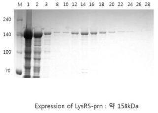 백일해 LysRS-prn 단백질 분리