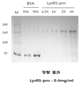 백일해 LysRS-prn 단백질 정량