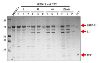 hRBD-L1 TEV cleavage의 solubility test