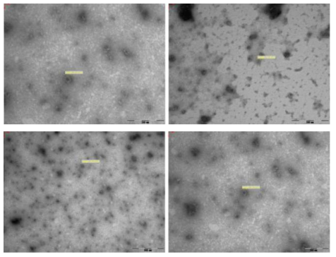 전자현미경을 이용한 구제역 바이러스 VLP 형성 확인