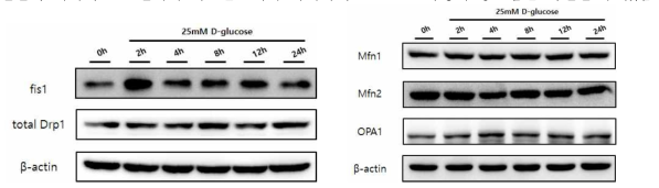 시간에 따른 당뇨성 심장질환의 체외세포 모델의 미토콘드리아 다이나믹스 단백질 발현 분석