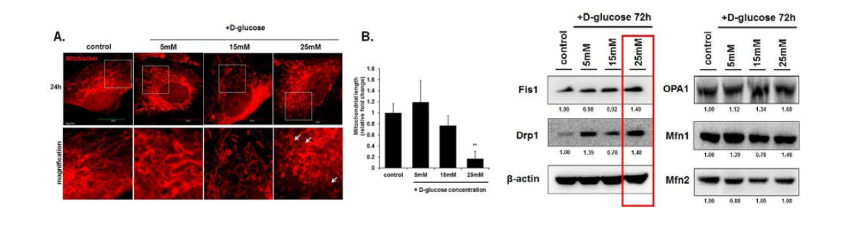 고혈당으로 인한 미세환경 기질세포 내 미토콘드리아의 형태학적 변화와 미토콘드리아 다이나믹스 관련단백질 발현분석