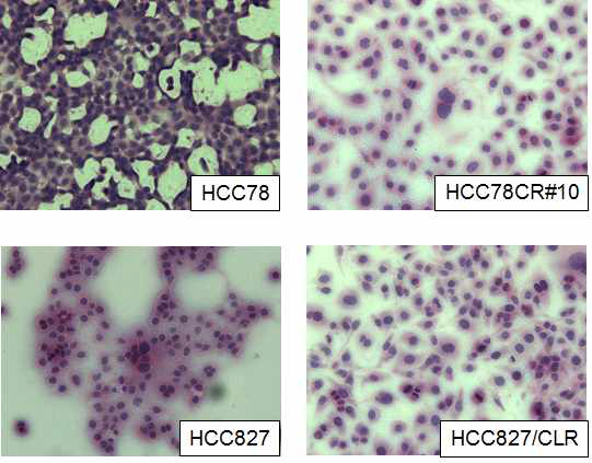 폐암 세포주와 항암제 내성 세포주
