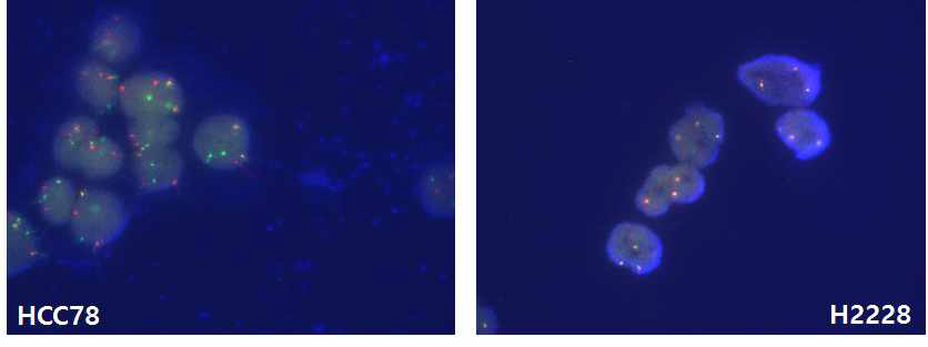 HCC827 (ROS1 변이)와 H2228 (ALK 변이) 폐암 세포주에서의 ROS1