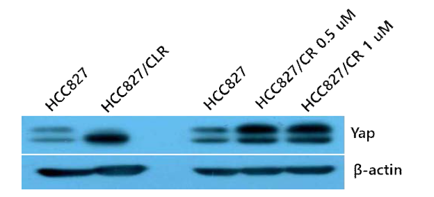 EGFR 변이 세포주 HCC827과 TKI 내성 세포주에서의 Yap 발현