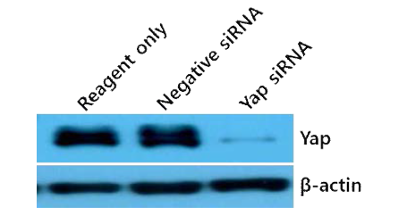 ROS1 변이 세포주 HCC78에서 Yap siRNA를 이용한 Yap 발현 저해