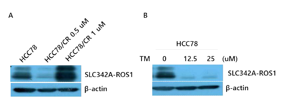 Crizotinib 내성 세포주 HCC78 (A)과 TM-induced ER stress에 대한 HCC78에서 ROS1의 발현 (B)