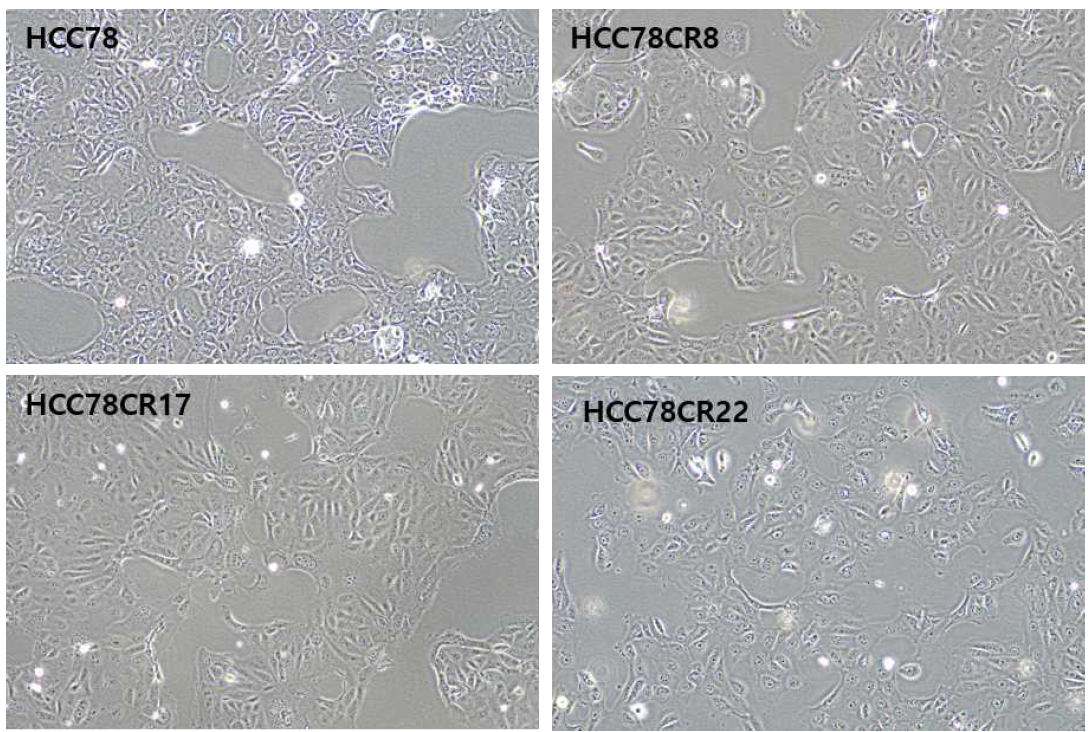 parent HCC78과 TKI 내성 세포주의 cell morphology