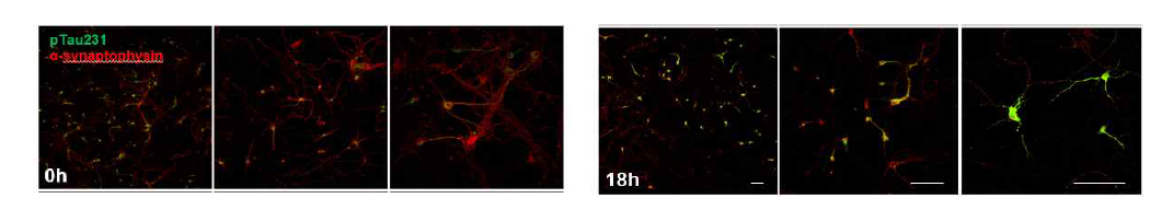 Immunocytochemistry로 Tau 인산화(초록)은 Akt phosphoryation 유도(오른쪽, 18H)와 함께 증가하면서 및 Synaptic 단백(빨강)의 소실이 관찰됨