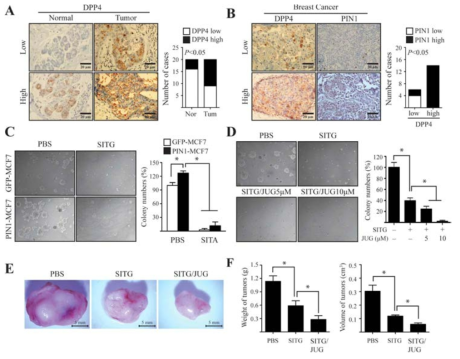 PIN1 overexpression induced by DPP4 is associated with human breast tumourigenesis