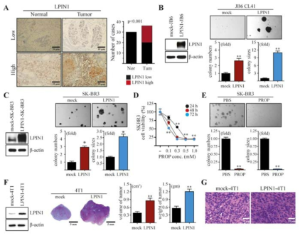 Overexpression of LIPIN1 enhanced epithelial cell transformation and breast tumourigenesis