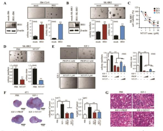 LPIN1 inhibits IRS1 degradation by the proteasomal and autophagic/lysosomal pathway