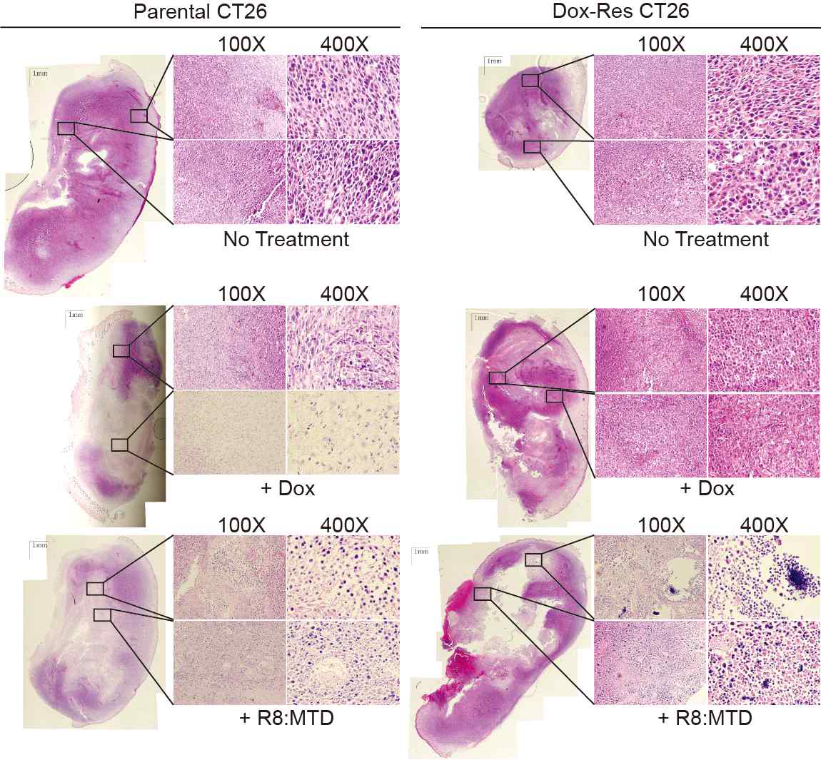 Intratumorla injection of Doxorubicin and R8:MTD Tumors were established in 6 week-old BALB/c mice by injecting 2.5 × 105 parental or Dox-Res CT26 cells into subcutaneous layer of mice backs. Then, 100μl each of R8:MTD(100 μM), Doxorubicin (20 μM), and saline were separately injected directly into tumor tissues once daily for 3 consecutive days. Then, 24 hours after final R8:MTD, Doxorubicin, and saline injections, tumor tissues were processed for hematoxylin and eosin staining after 4% formaldehyde fixation and paraffin embedding Images of whole tumor tissues (magnification 40x) were taken using a light microscope and phto-merged using Adobe Photoshop CSA5