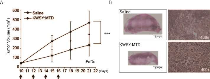 FaDu cells were inoculated into backs of SCID mice. Tumors wer formed after 10days. (A) KWSY:MTD(0.4 mM, 200μl) or PBS were I.v. injected into the tail vain of FADU tumorigenic mice(n=6) every 2days interval total 4times(as indicadted arrows). (B) Isolated tumors of FaDu tumorigenic mice were stained with H&E, and images taken(magnification 400x) and merged using Adobe Photoshop Cs5