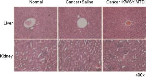 Isolated livers and kidney from FaDu tumorigenic mice were stained with H&E, and images taken(magnification 400x)