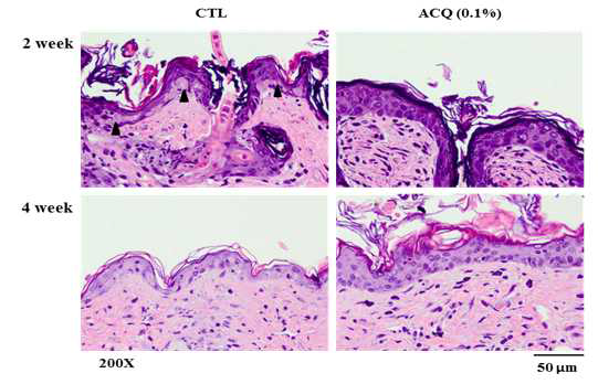 Protective effects by ACQ against UV irradiation Control mice and ACQ fed mice (2 and 4 weeks) were irradiated with 600 mJ/cm2 of UVB.In control mice, epidermis became thinner and apoptotic cells were observed. But in ACQ fed mice, epidermis became thicker and severe damage was not observed. Experiment was repeated for 2 times and representative data is shown