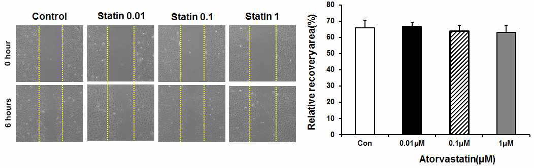 Atorvastatin 처리에 따른 혈관줄기세포의 이동능 변화 검증