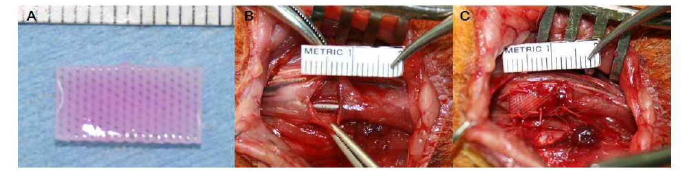 Partial esophageal defect 동물모델에서 제작된 인공식도 이식물을 삽입함