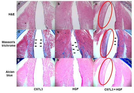 Hyaluronic acid staining (Alcian blue staining) (아래), Collagen depostion (Masson´s trichrome staining) (가운데)를 이용하여 양측 성대에 scarring 및 HGF-C97L3 diblock co-polymer treatment를 시행한 후 ECM의 변화를 평가함. HGF-C97L3 diblock co-polymer treatment group에서 가장 favorable 한 ECM 구성을 보여서 HGF-C97L3 diblock co-polymer 에 의해 sustained release 된 HGF가 ECM remodeling을 일으켰음을 확인함