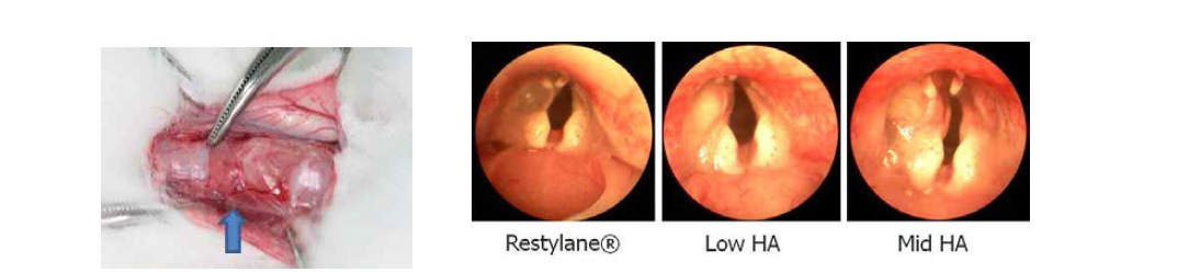 되돌이 후두신경 손상 성대마비 동물모델 (좌측) 에서 기존의 Restylene® 과 새롭게 개발된 Mid, low viscosity HA filler의 injection을 시행함