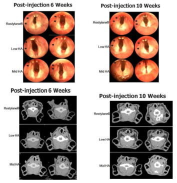 성대마비 동물모델에서 기존의 Restylene® 과 새롭게 개발된 Mid, low viscosity HA filler의 injection 시행 후, 6주 및 10주 후 내시경적 평가를 시행. 이후 CT를 시행하여 injection volume을 확인함. 새로운 Mid HA filler가 다른 group에 비해 원래의 injection volume이 original injection site에 잘 유지됨을 확인함