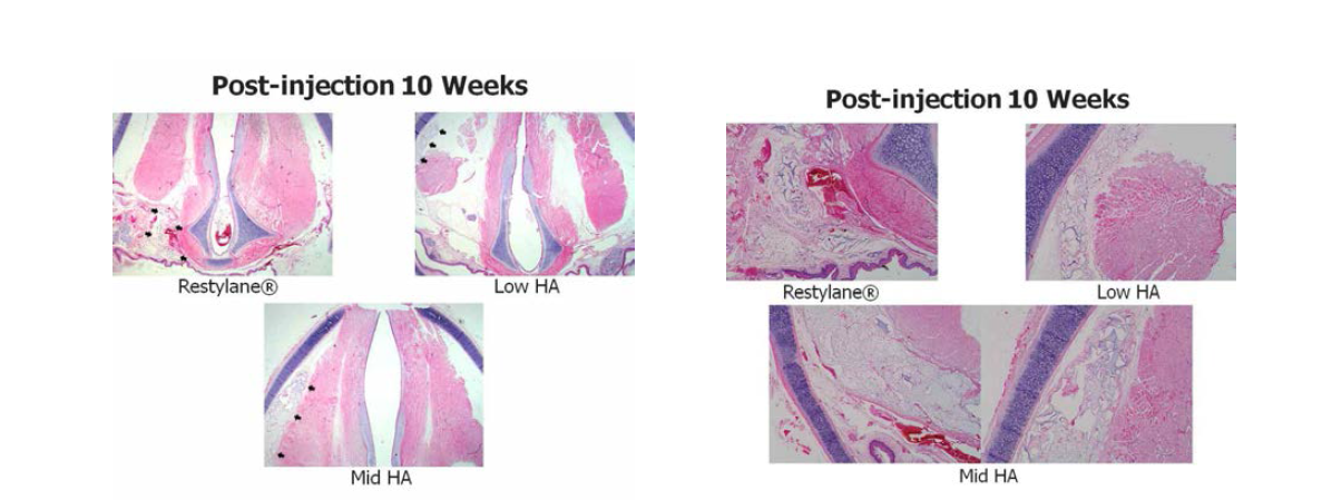 H&E staining에서 새로운 Mid HA filler가 다른 group에 비해 원래의 injection volume이 original injection site에 잘 유지됨을 확인함