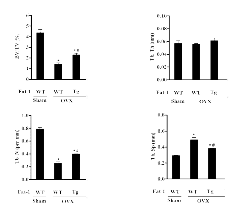 Micro-CT로 확인한 ω-3를 과다 생산하는 난소-절제 Fat-1 transgenic 마우스에서의 골량 증가 효과