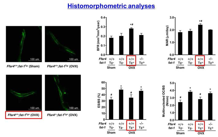 AIN-93M 식이를 진행한 16주령 female Ffar4-/-;fat-1Tg+ littermates 에서의 histomorphometric 분석 결과