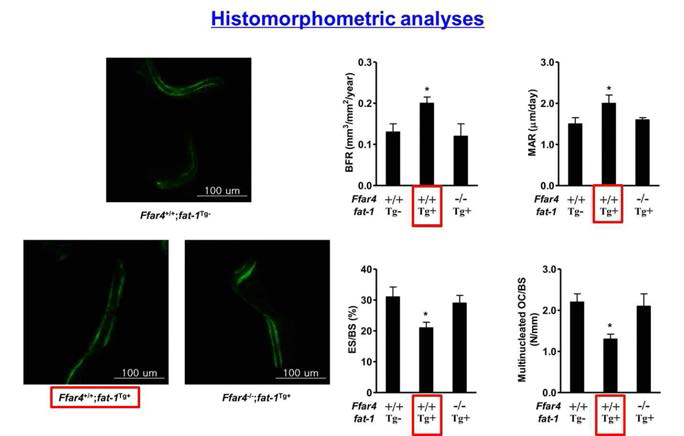 8주간 고지방식이를 진행한 male Ffar4-/-;fat-1Tg+ littermates 에서의 histomorphometric 분석 결과