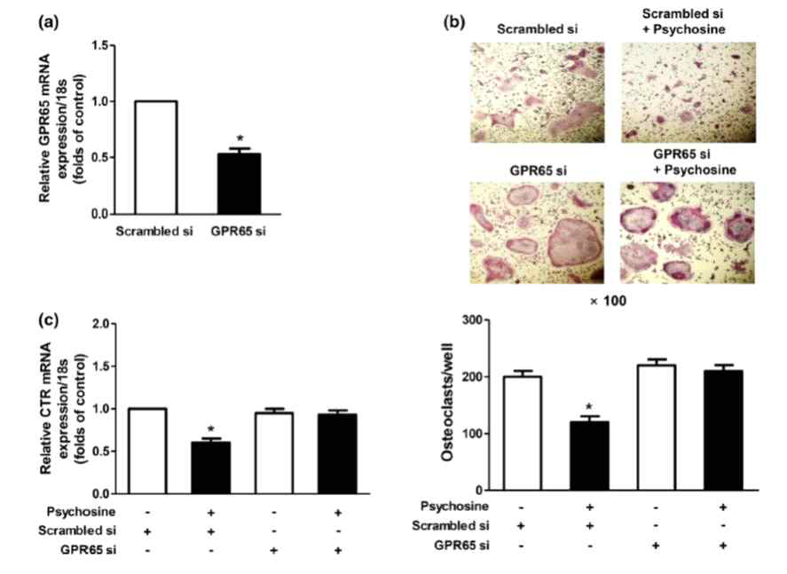 Psychosine의 파골세포작용에 대한 GPR65 특이성 확인