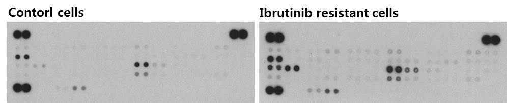 ABC DLBCL 대조군과 Ibrutinib 내성 세포에서 phospho RTK-assay 관찰