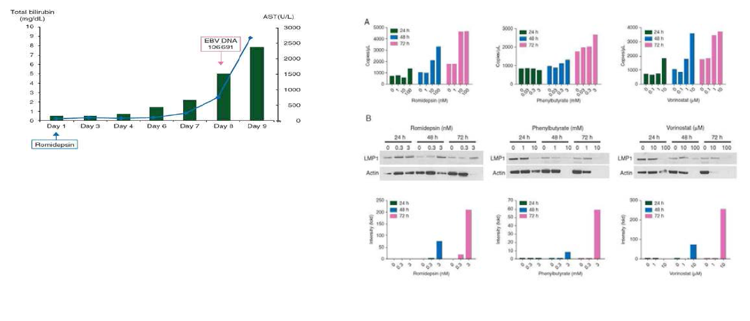 ENKTL 환자에서 romidepsin 에 따른 bilirubin 증가와 함께 EBV DNA 의 copy 수가 증가 (왼쪽) 와 SNK6 세포주에 romidepsin, PB, vorinostat을 시간과 농도별로 처리하였을때, EBV DNA copy 수 변화와 LMP1 발현 확인